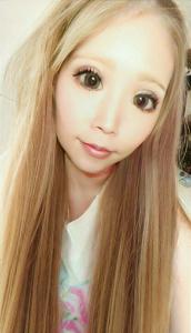 アルビナ